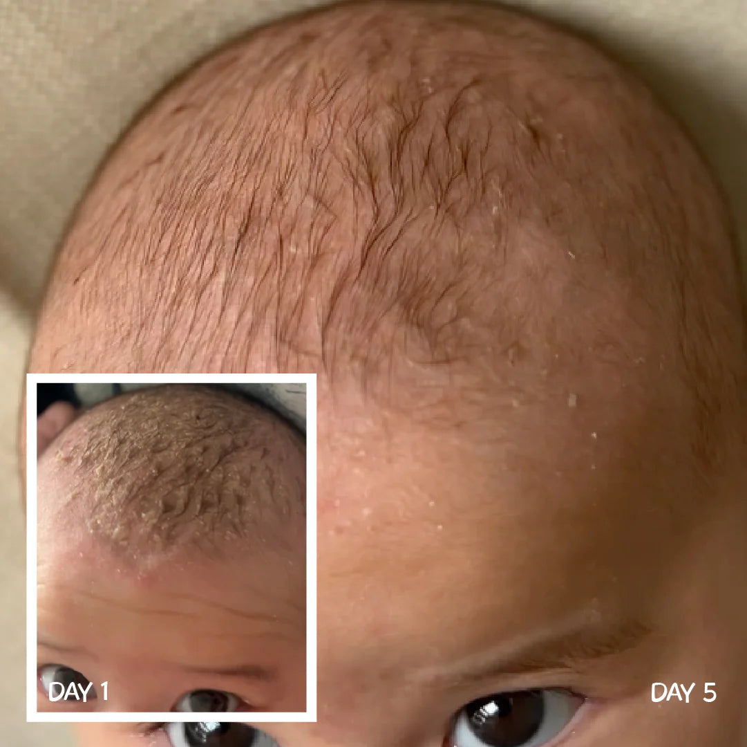 Moogoo Baby Scalp Cream 120g